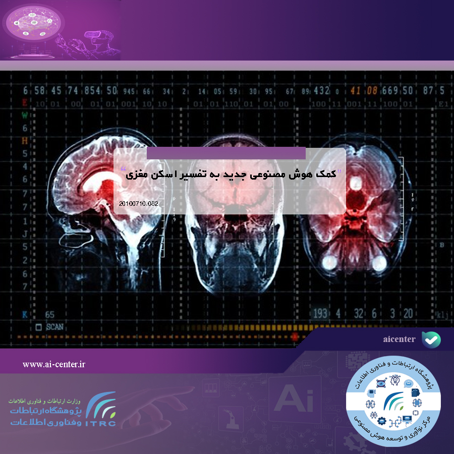 کمک هوش مصنوعی جدید به تفسیر اسکن مغزی