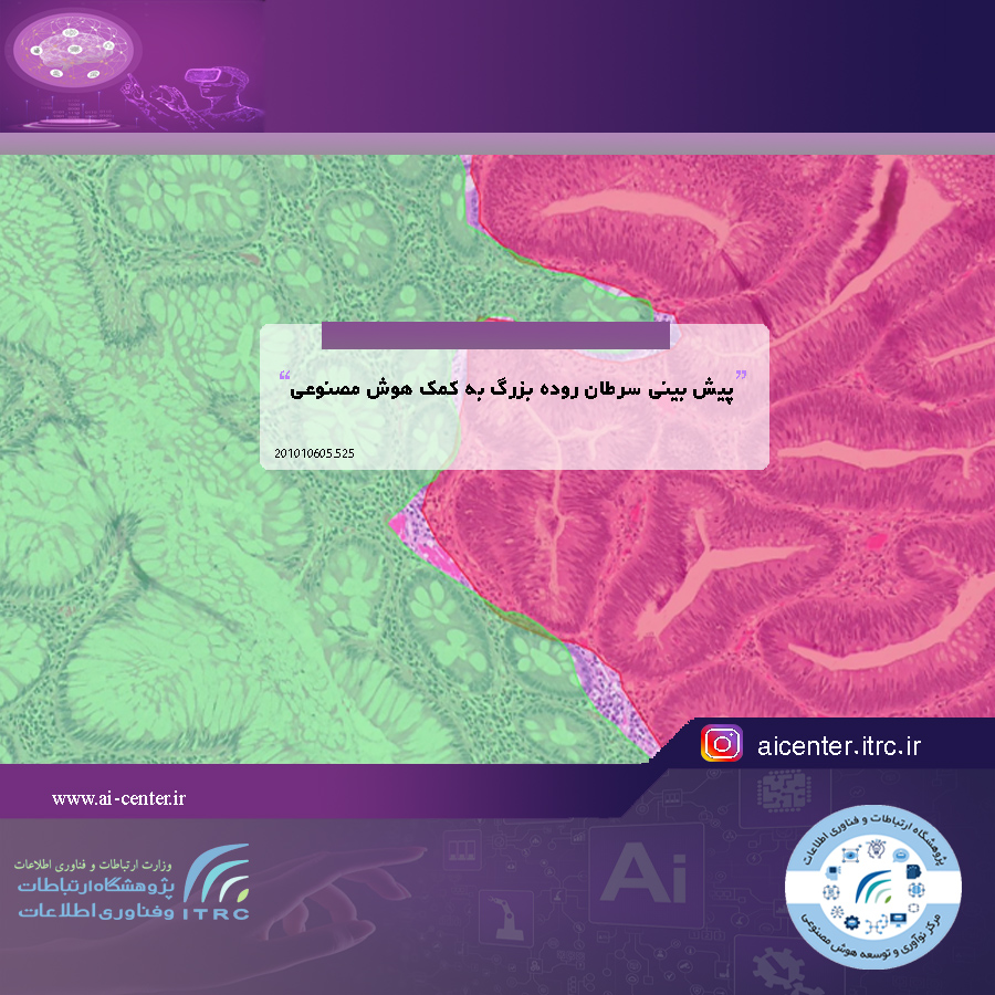 پیش بینی سرطان روده بزرگ به کمک هوش مصنوعی