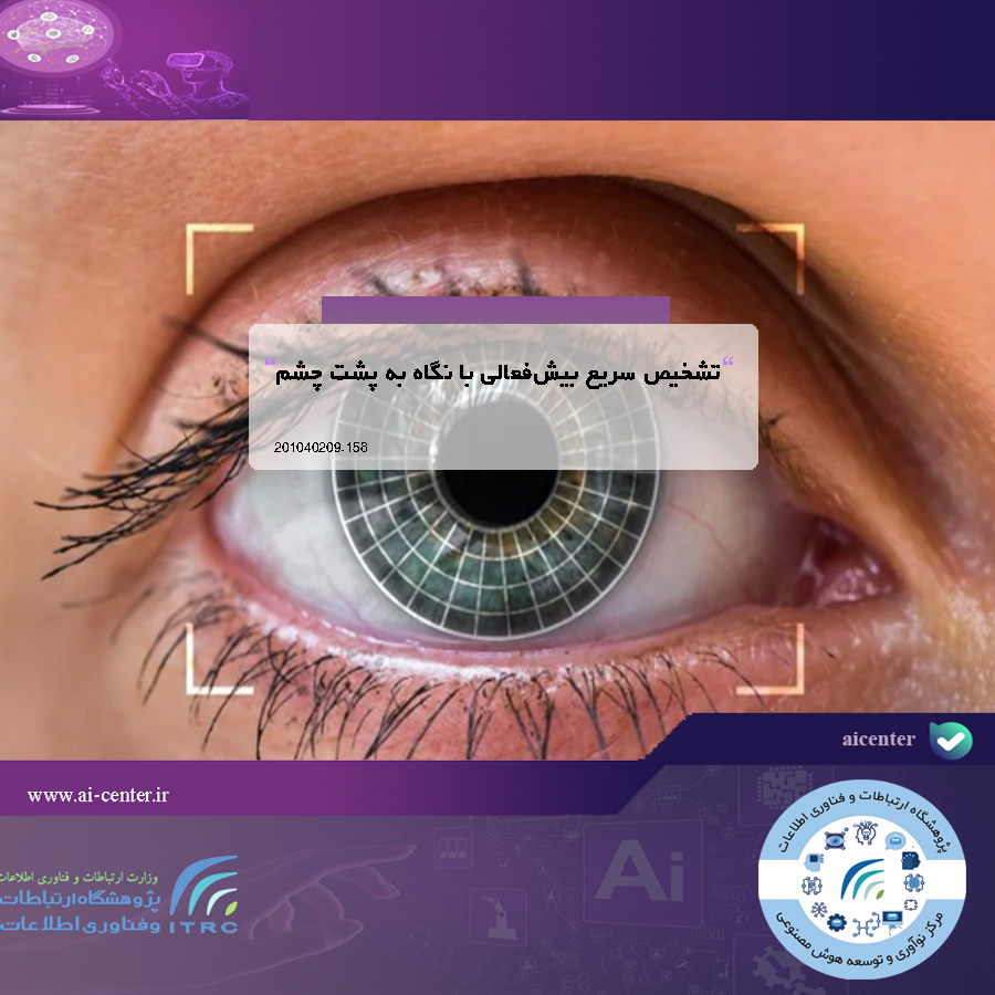 تشخیص سریع بیش‌فعالی با نگاه به پشت چشم