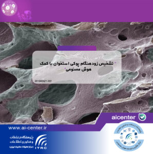 تشخیص زودهنگام پوکی استخوان با کمک هوش مصنوعی