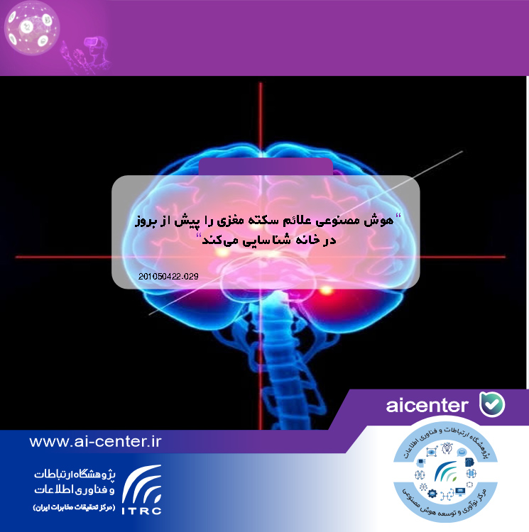 هوش مصنوعی علائم سکته مغزی را پیش از بروز در خانه شناسایی می‌کند